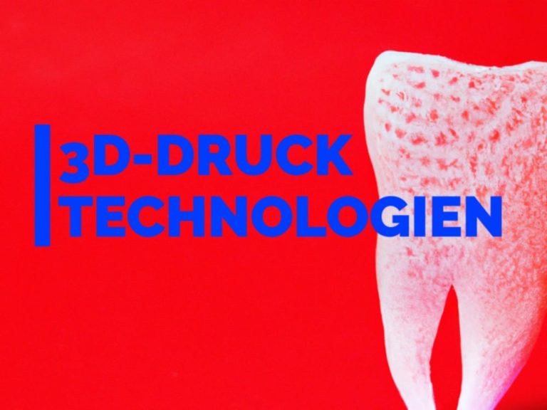 Die richtige 3D-Drucktechnologie im Dentallabor