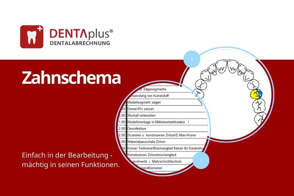 Blogartikel zur Funktion des Zahnschemas